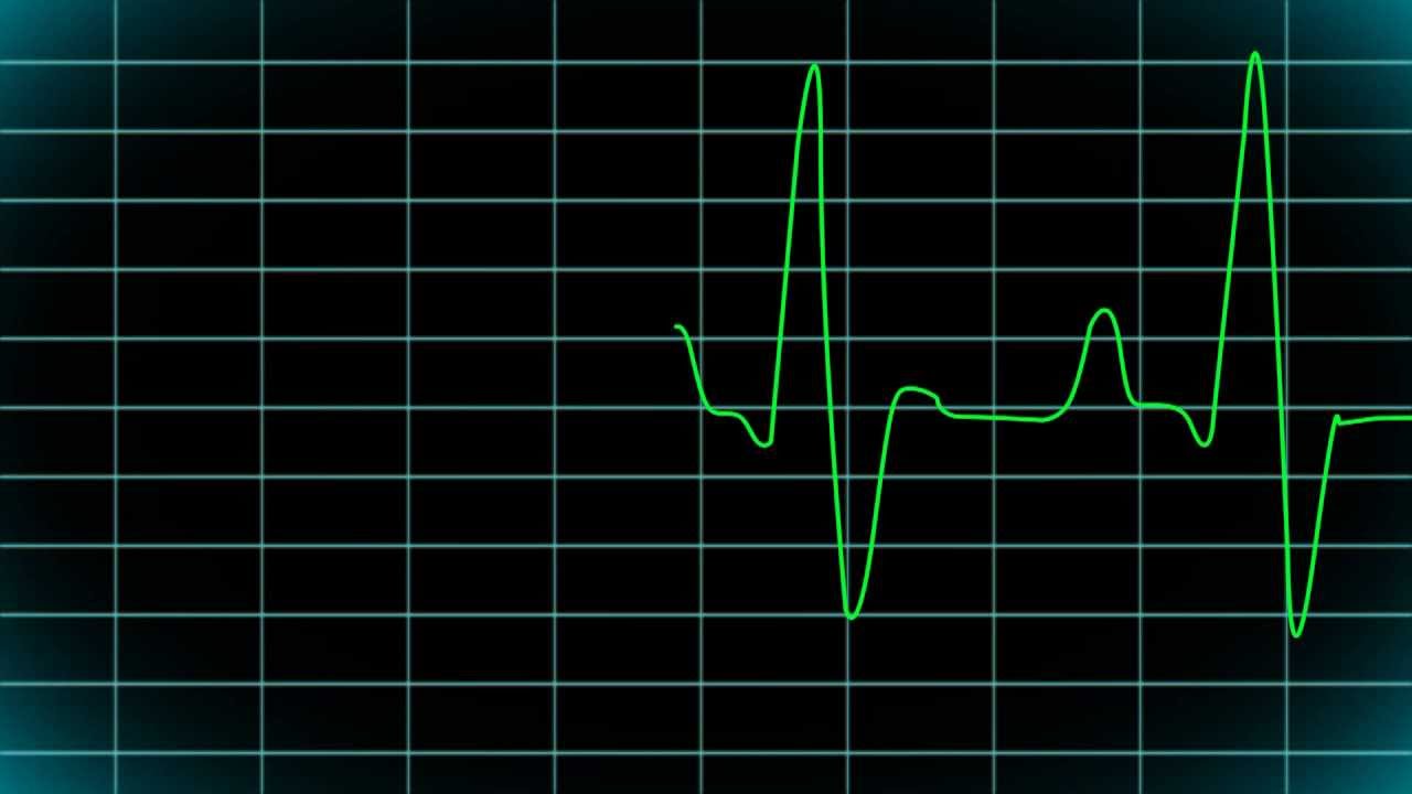 Les scientifiques de l'université de tchliabinsk ont créé un t-shirt, sans contact измеряющую de l'ECG