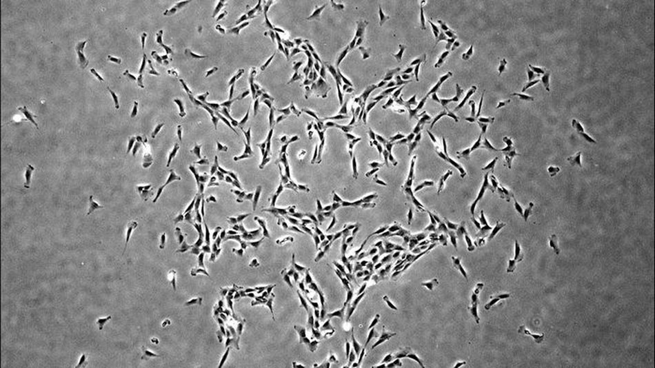 Scientists first identified the human bone stem cells