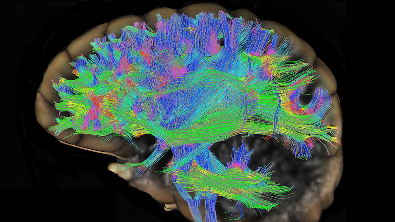 An antibiotic prolonged life and protection from neurodegenerative diseases