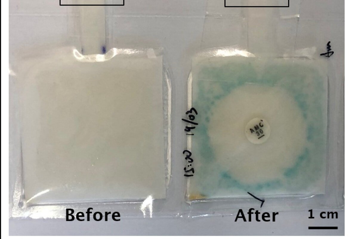 You have created a test that suggests the appropriate antibiotic to treat the disease