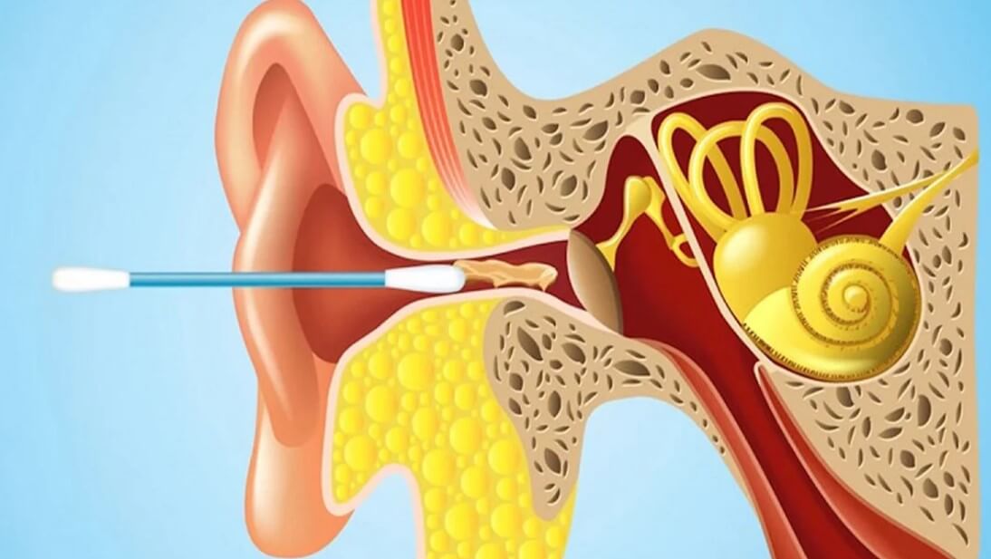 Some people are able to create their own noise in the ears