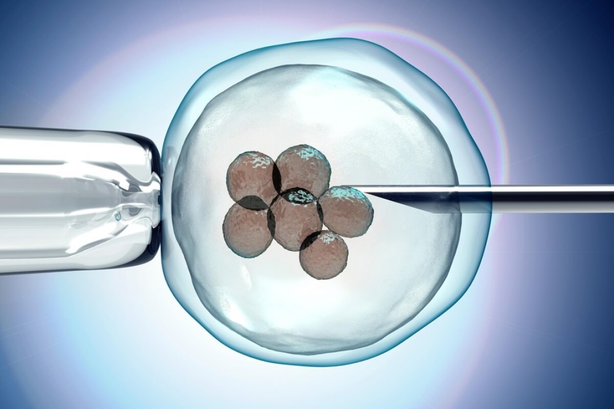 What you need to know about the duration of the procedure and effectiveness of ECO?